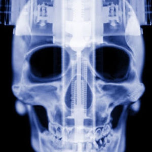 Meet your Posher, Tyrone